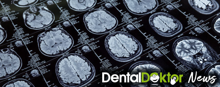 Enfermedades bucales y neurodegenerativas, ¡tan lejos o tan cerca!