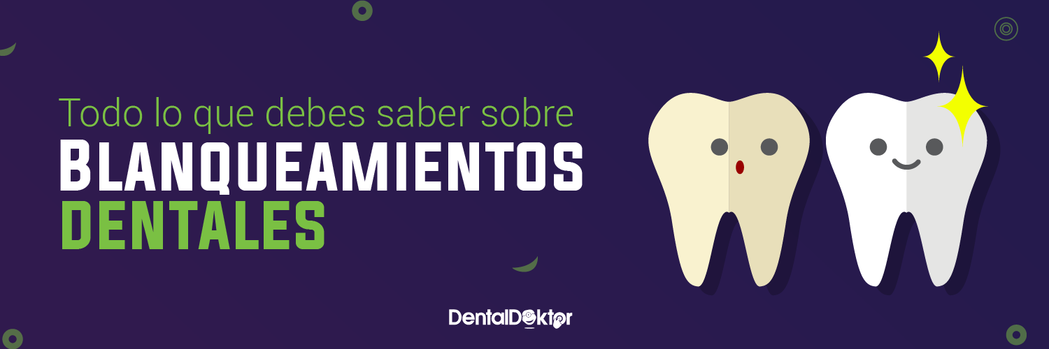Todo lo que debes saber sobre blanqueamientos dentales