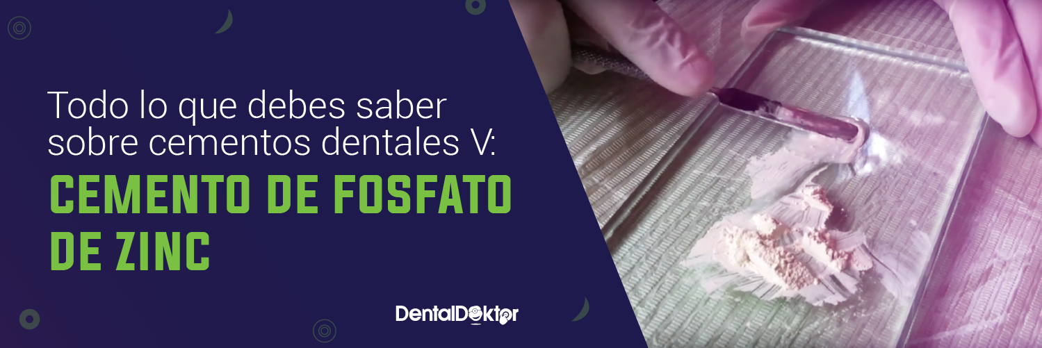 Todo lo que debes saber sobre cementos dentales (capítulo 2)