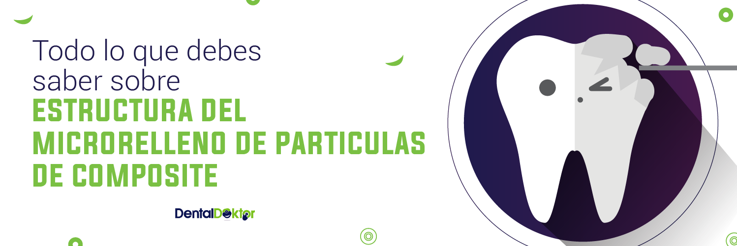 Todo lo que debes saber sobre estructura del microrelleno de particulas de composite