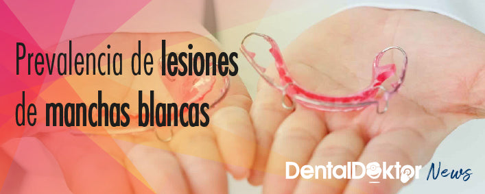 Lesiones de manchas blancas en Ortodoncia