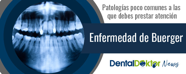 Enfermedad de Buerger y casos reportados en Colombia