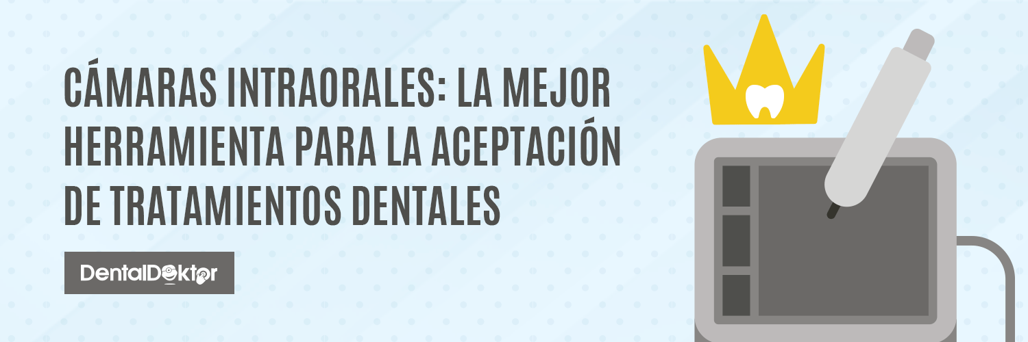Cámaras intraorales