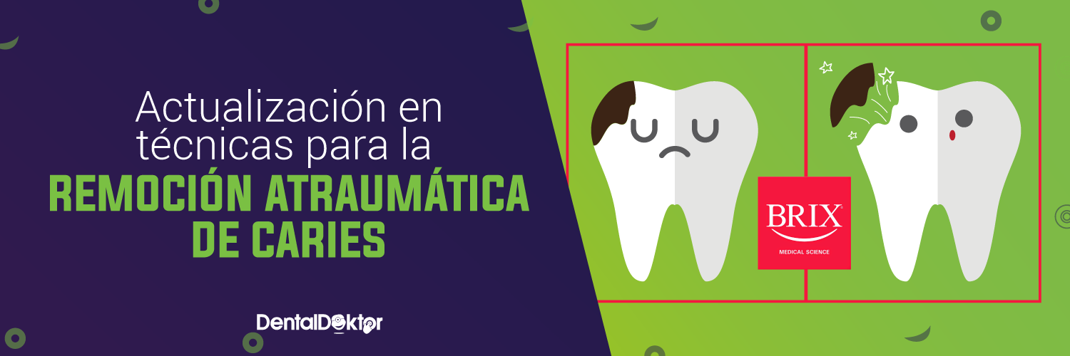ACTUALIZACIÓN EN TÉCNICAS PARA LA REMOCIÓN ATRAUMÁTICA DE CARIES