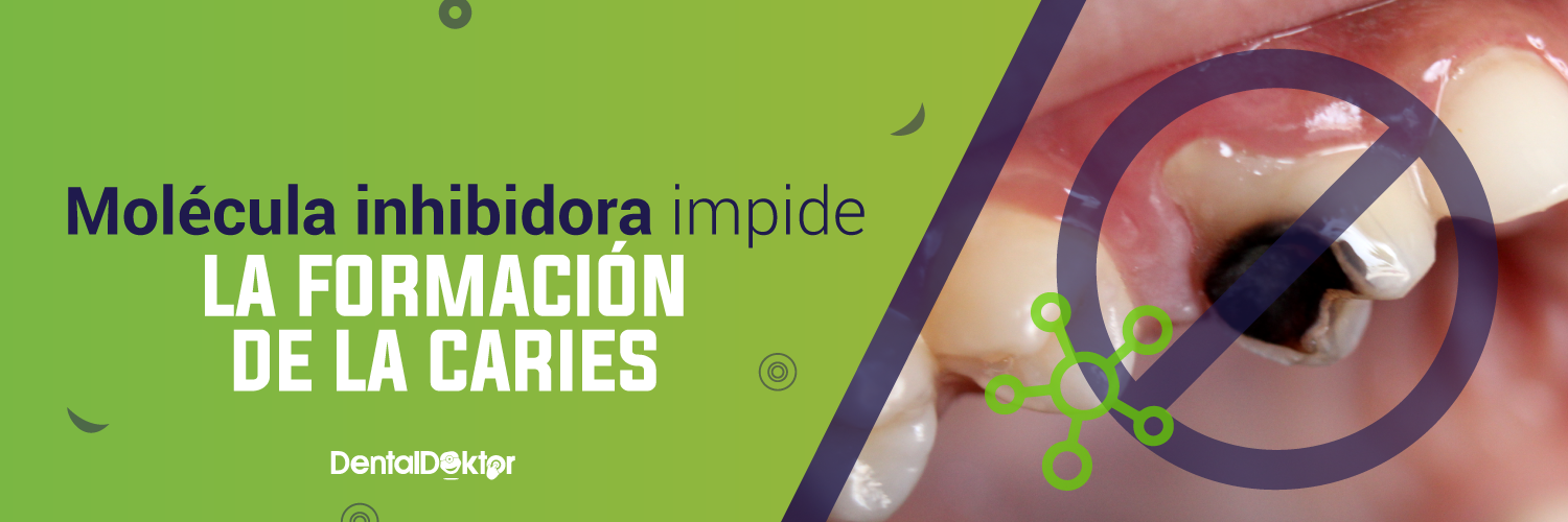 Molécula inhibidora impide la formación de la caries
