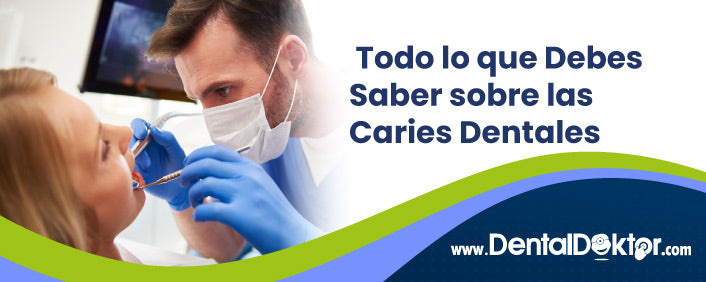 Todo lo que Debes Saber sobre las Caries Dentales