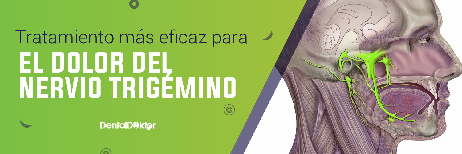 Tratamiento más eficaz para el dolor del nervio trigémino