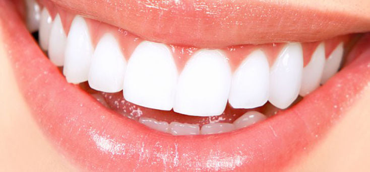 Aclaramiento dental – Tendencias en el mundo